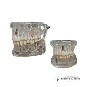 Tipodonto p/Implantes (estudio)